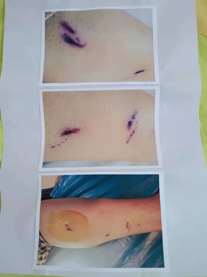 給狗接種狂犬疫苗_狂犬疫苗狗_狗狂犬疫苗多少錢(qián)